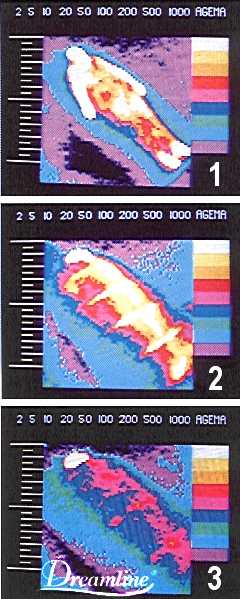 Thermografie 1-3